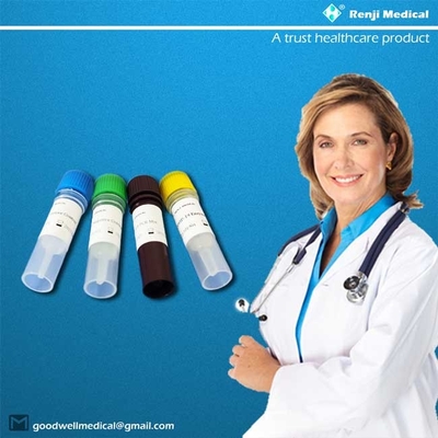 ژن ORF1ab کیت های تست خانگی ویروس کرونا نتایج کامل 40-90 دقیقه