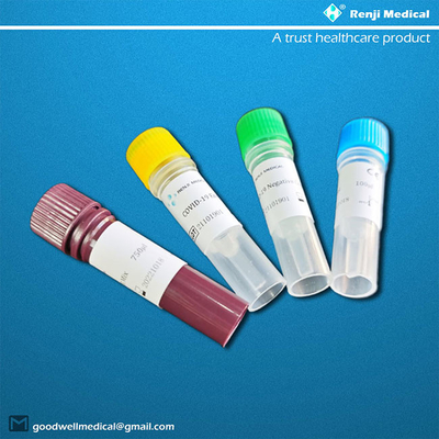 کیت تست واکنش زنجیره ای پلیمراز ORF1ab گواهی SDS CE