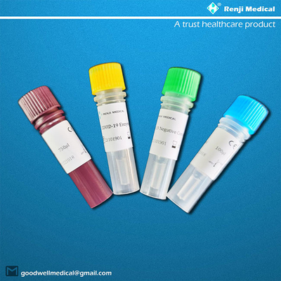کیت تست اسید نوکلئیک کاوشگر فلورسانس، تست سریع کروناویروس جدید RT-PCR